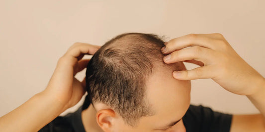 How to Incorporate Minoxidil into Your Hair Routine for Best Results