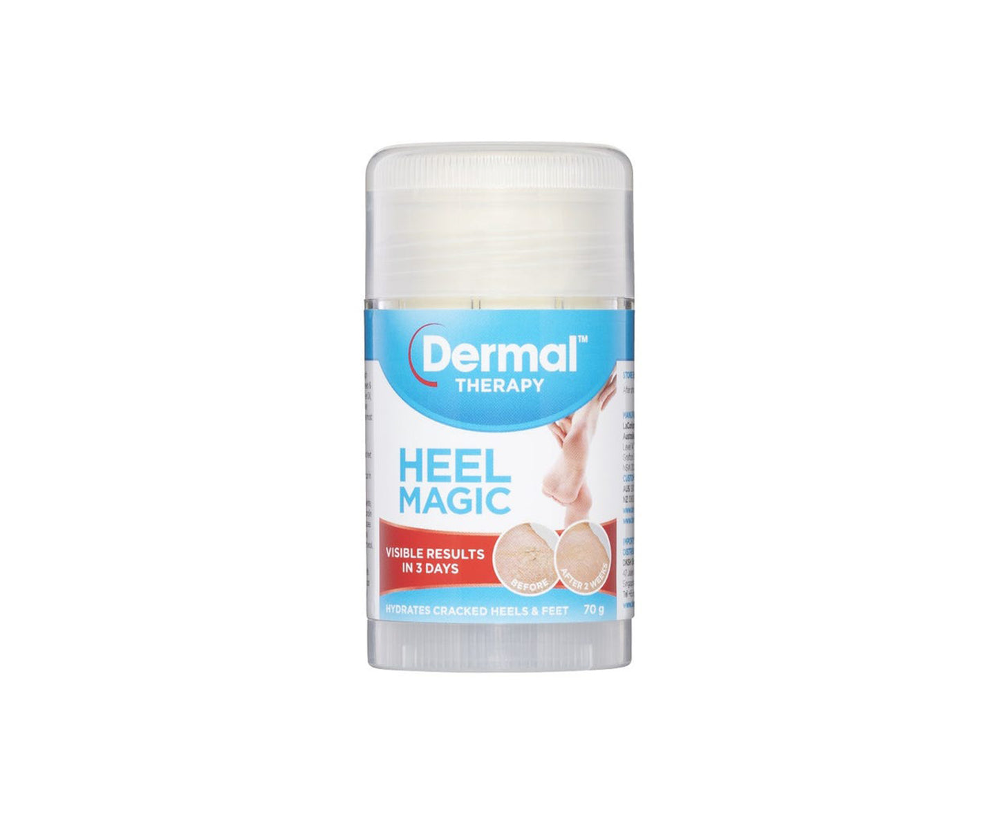 Dermal Therapy Heel Magic 70g