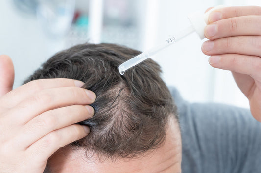 Compounding Hair Loss Minoxidil in Australia: Why Personalised Hair Regrowth Treatments Are on the Rise