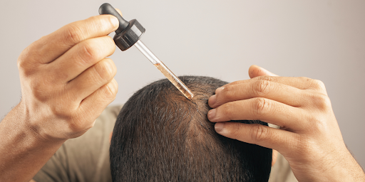 The Complete Guide to Getting and Using Minoxidil