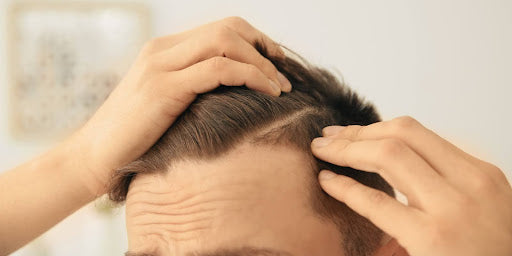regain confidence with hair loss compounding
